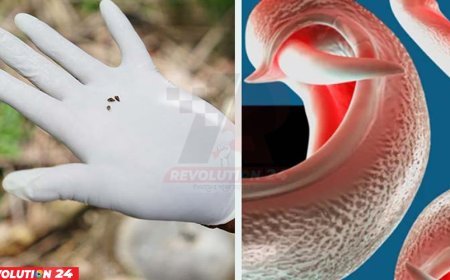 বিভিন্ন দেশে ছড়াতে পারে যৌনাঙ্গ আক্রান্তকারী পরজীবী, সতর্ক করলেন বিজ্ঞানীরা