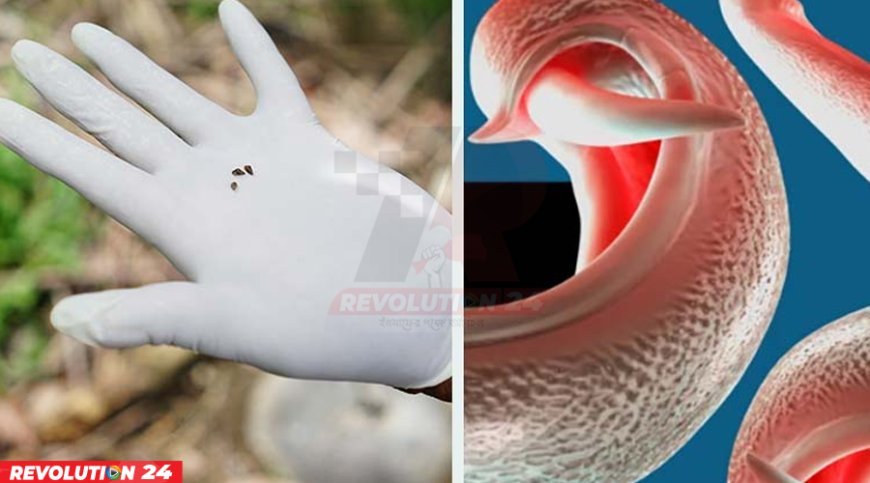 বিভিন্ন দেশে ছড়াতে পারে যৌনাঙ্গ আক্রান্তকারী পরজীবী, সতর্ক করলেন বিজ্ঞানীরা