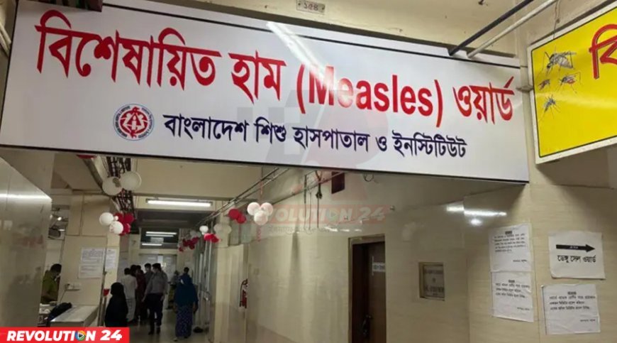 হাম ও হামের উপসর্গে আরও চারজনের মৃত্যু